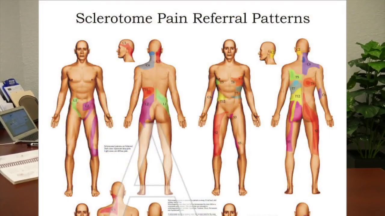 Pain Without An Actual Injury? The Answer Is Here! - YouTube
