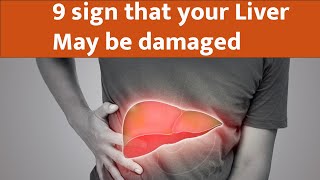 9 sign that your liver may be damaged I sign of liver damage
