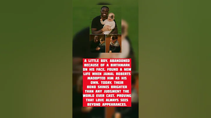Abandoned Baby with Birthmark Gets Adopted by Loving Father ❤️ #celebritynews