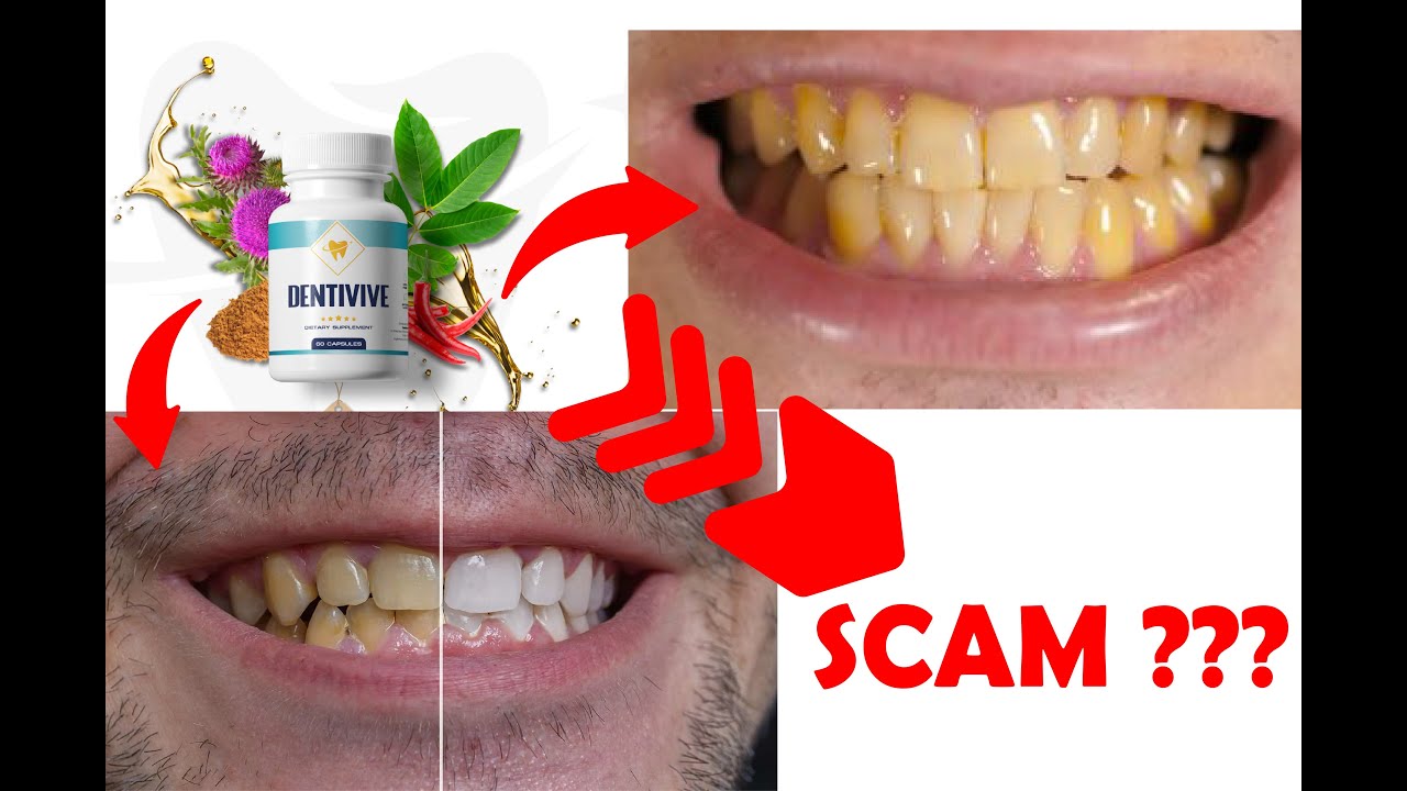 Dentivive review – WATCH BEFORE YOU BUY