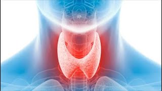 مخاطر استئصال الغدة الدرقية