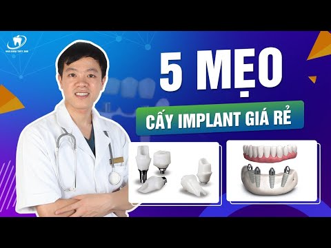 Video: 10 Cách Tìm Cấy Ghép Nha Khoa Chi Phí Rẻ