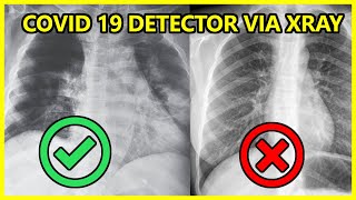 Detect COVID 19 From X-RAY using Deep Learning | Walk Through | BRAIN
