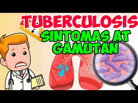 Tuberculosis: Sintomas at Gamutan - Payo ni Doc Willie Ong #687b