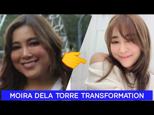 moira dela torre before glutathione Look at Moira's weight loss transformation Moira (Moira Dela Torre EP)