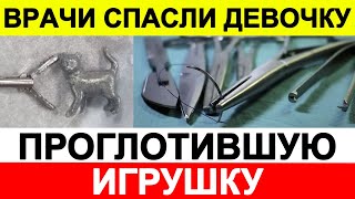 Врачи спасли девочку, проглотившую игрушку