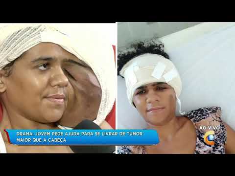 Vídeo: Menina De 3 Anos Com Um Tumor Enorme No Rosto Sorri Novamente