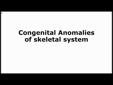 Congenital Anomalies of Skeletal system | Embryology