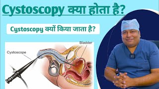 ससटसकप सरजर कय ह और कय कय जत ह ? Cystoscopy In Hindi Dr Amit Kumar Jha