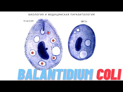 Балантидий (Balantidium coli) Балантидиаз