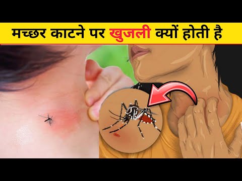 वीडियो: मच्छर के काटने पर अभिषेक कैसे करें ताकि घर पर खुजली न हो