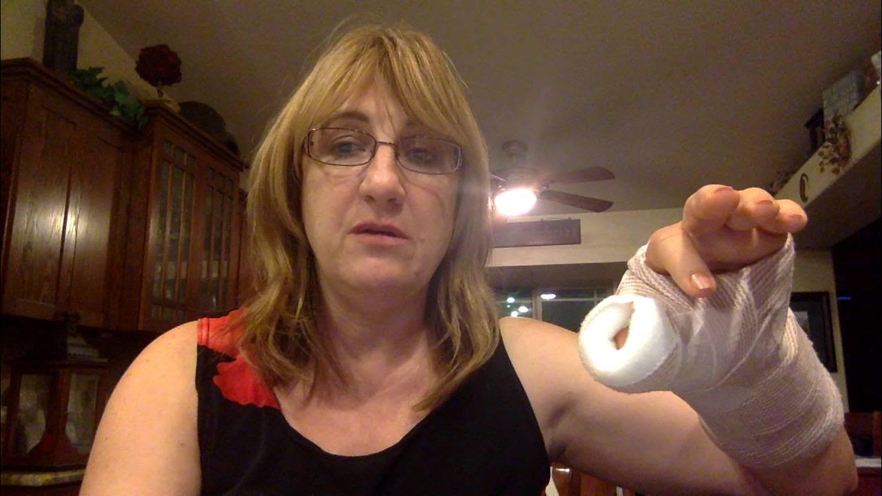 arthritis thumb surgery YouTube