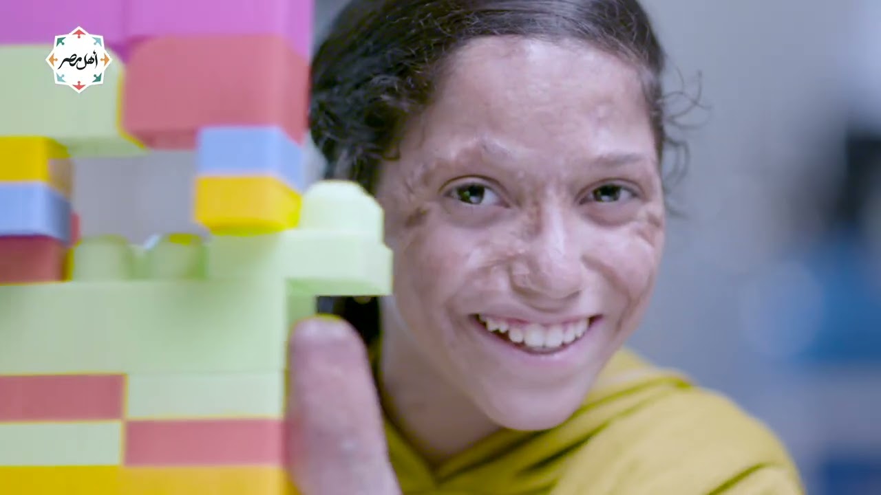 مستشفى حروق أهل مصر - مستشفى مميزة