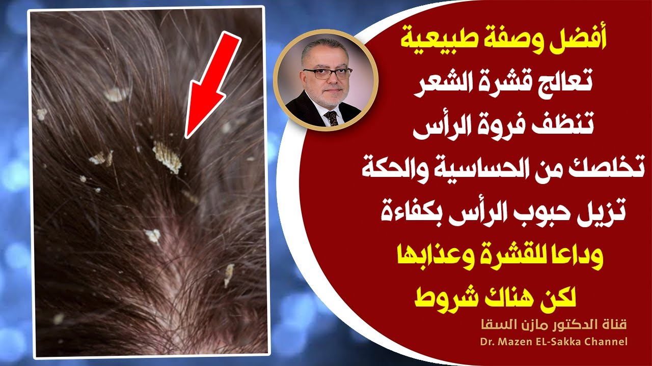 أعظم الهدايا الربانية يعمل ضد القشرة يعالج تساقط الشعربقوة يكافح القشره وحبوب وحكة فروة الرأس بكفاءة