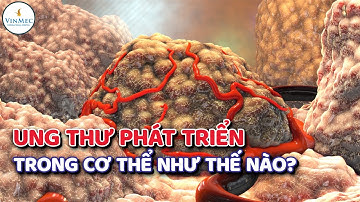 Ung thư phát triển trong cơ thể như thế nào?| BS Phan Trúc, BV Vinmec Times City