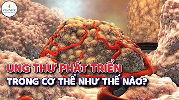 Ung thư phát triển trong cơ thể như thế nào?| BS Phan Trúc, BV Vinmec Times City