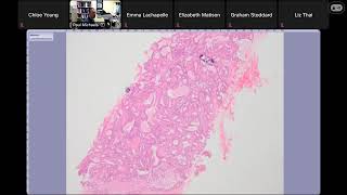 Virtual Pathology Slide Session (6/20/25) with Dr. Paul Michaels