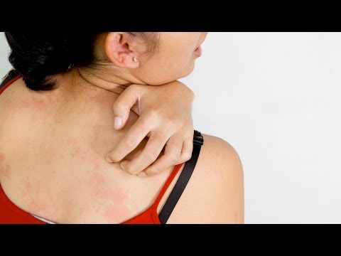 Is Itchy Skin a Sign of Skin Cancer? | Skin Cancer