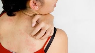 Is Itchy Skin a Sign of Skin Cancer? | Skin Cancer