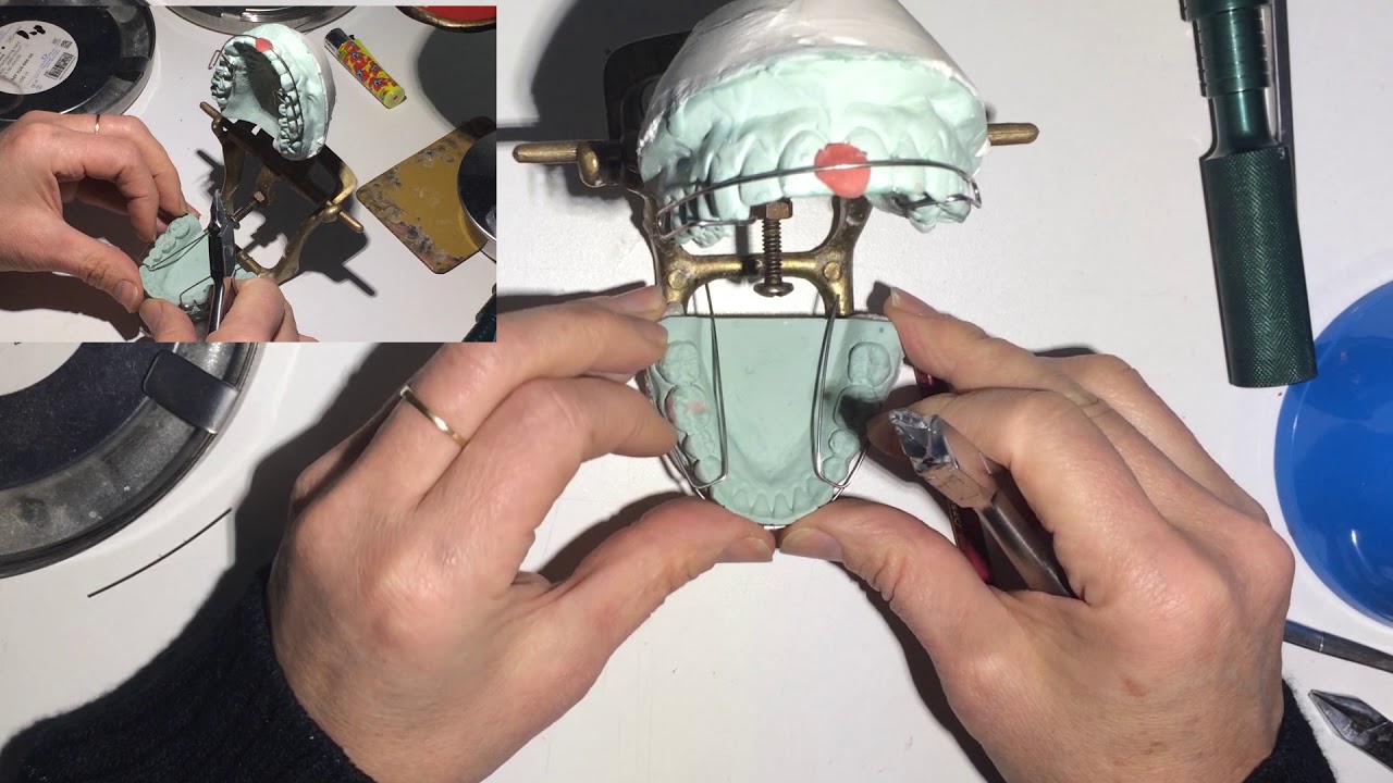 Cómo hacer un activador Klammt 2/4