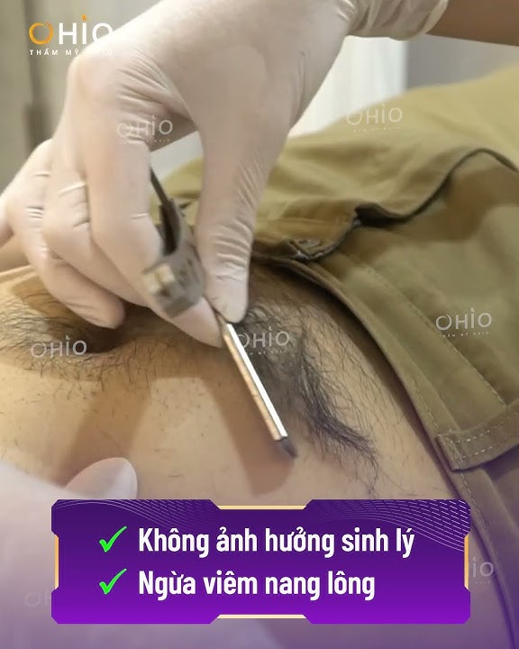 Triệt lông vùng kín bằng công nghệ AQUA MAX PRO