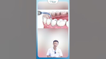 Hiệu Quả Của Máy Tăm Nước Để Vệ Sinh Răng Miệng | Bác Sĩ Yên