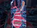 Spokesperson says Lindsey Graham died due to aortic dissection, according to early findings #shorts