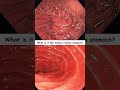 What is it like inside a human stomach? #science #health