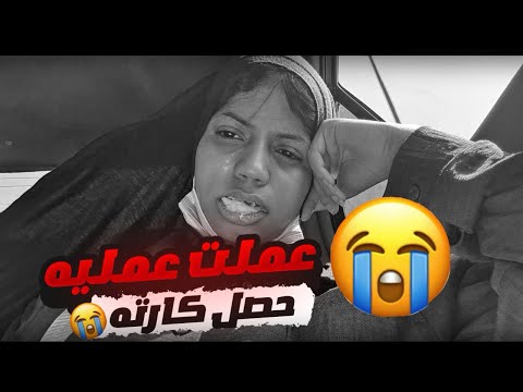 يارتني ما عملت العمليه