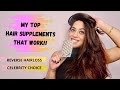 My Top Hair Supplements | Stop Hair Loss & Regrow Hair | Sonali Beauty