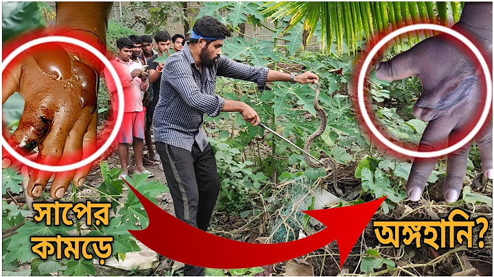 অঙ্গহানির জন্য দায়ী এই সাপ! Russell's Viper Fatality | বিশাল চন্দ্রবোড়া সাপ!@SnakeSaverBrothers