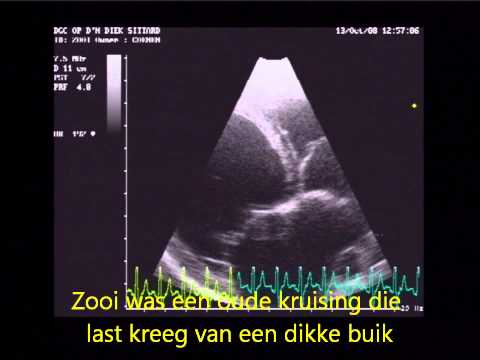 Video: Cardiomyopathie Bij Bokserhonden