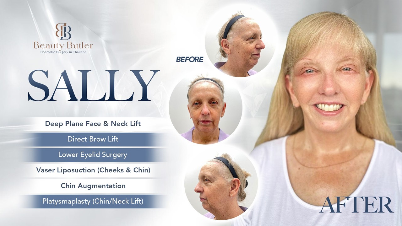 Facelift Thailand — Beauty Butler