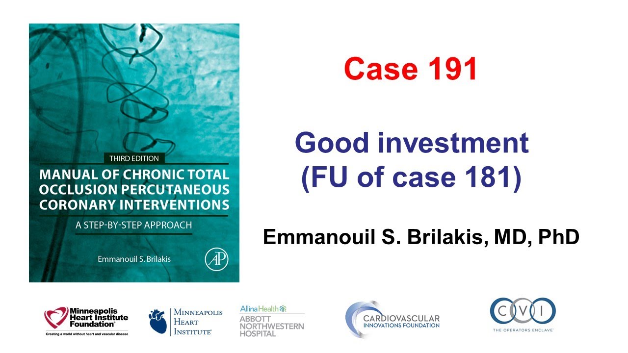 Case 191: Manual of CTO PCI - Good investment!