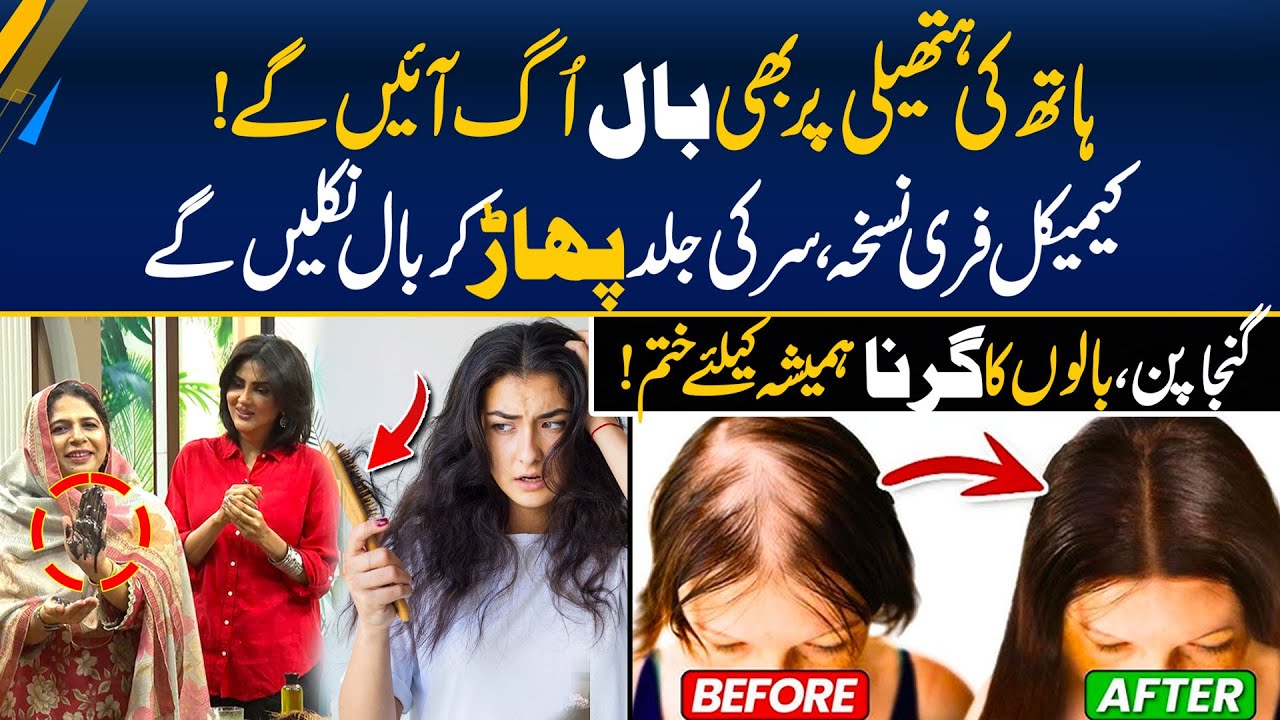 Stop Hair Fall & Baldness - 100% Natural Solution - Regrow Hair Naturally - Morning With Fiza