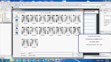 Recognizing Common CT Imaging Signs of  Lung Diseases through a New Feature Selection  Method