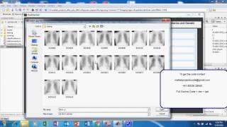 Famous Recognizing Common CT Imaging Signs of Lung Diseases through a New Feature Selection Method Net Worth