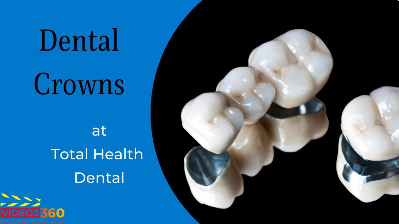 Dental crowns at Total Health Dental - Dr. Khaja Mohsinuddin
