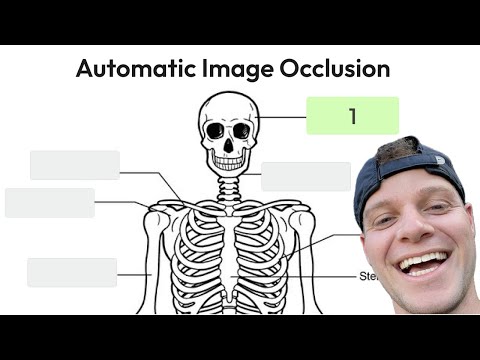 How to Do Automatic AI Image Occlusion in Wisdolia + Export to Anki