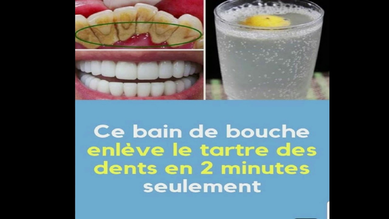 METHODE NATURELLE POUR AVOIR DES DENTS PROPRES ET BLANCHES - YouTube
