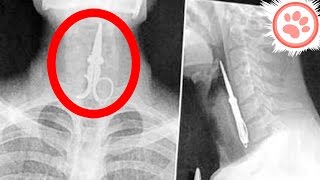 12 Strangest Things Ever Found In X-Rays