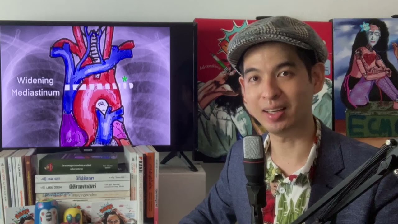 อ่านCXRCฉุกเฉินเบื้องต้น ตอนที่1: Pericardial Effusion/Cardiac Tamponade/Aortic Dissection