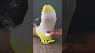 как улучшить состояние пятки #здоровье #рецепт #пятка #лечение #стопа #нутрициолог #кожа #нога