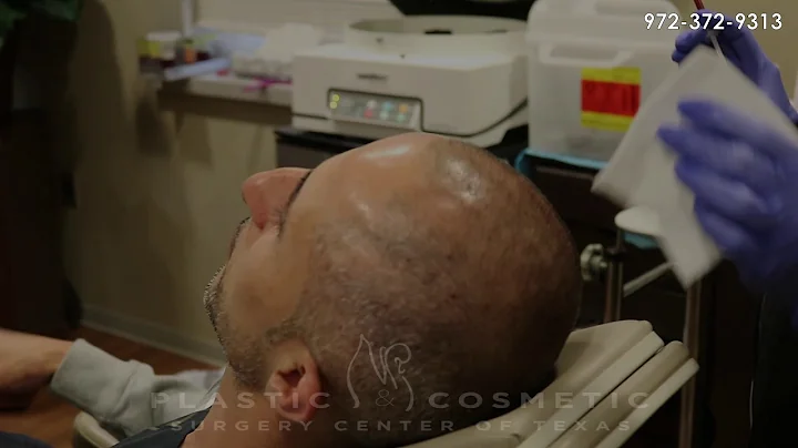 Hair Restoration Using PRP - Featuring: Vicki McQu...