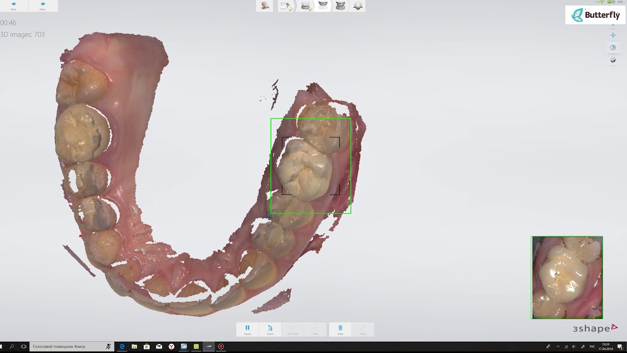SCANNING 3Shape TRIOS 3 WIRELESS