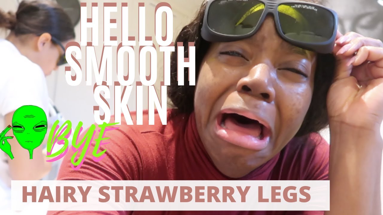 LASER HAIR REMOVAL: HOW TO GET RID OF STRAWBERRY LEGS (HELLO SMOOTH SKIN) :  VOGUE CLINIC AMSTERDAM - YouTube