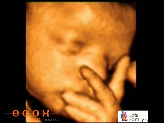 Ecografia 4d El Bebe Con 34 Semanas De Gestacion Youtube