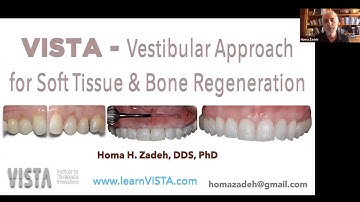 VISTA - Vestibular Incision Subperiosteal Tunnel Access