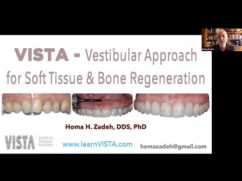 Video: Unde este localizat subperiostul?