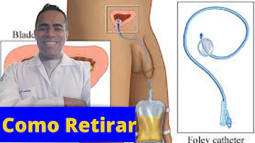 Como fazer o desmame da sonda vesical de demora?